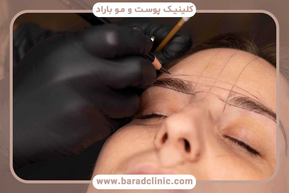 Is it possible to implant eyebrows on a tattoo?