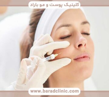 باید قبل از تزریق بوتاکس