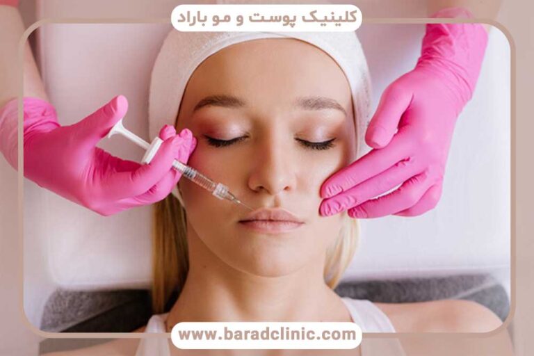 Filler injection