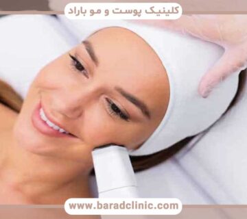 RF treatment