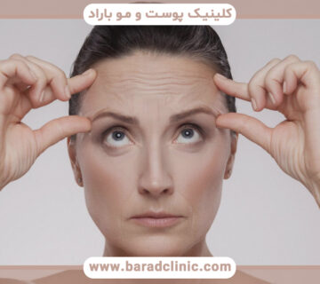 کاهش خطوط ریز و چین و چروک
