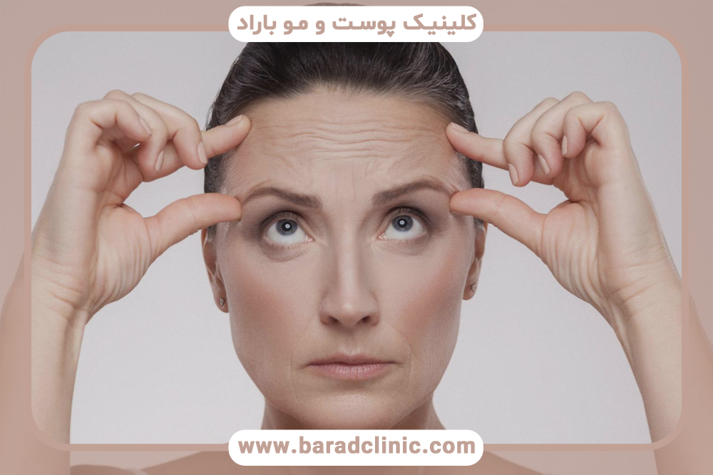 کاهش خطوط ریز و چین و چروک