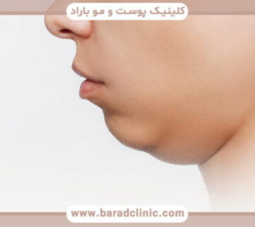 راههای غیرجراحی لیفت گردن برای افتادگی پوست