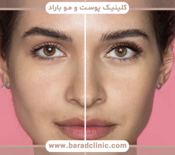 راههای درمان نامتقارن بودن فک چیست؟