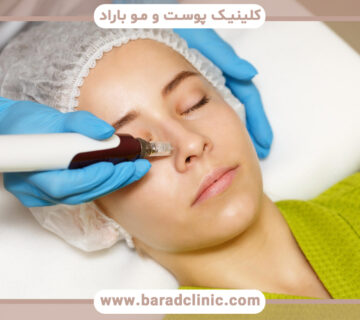 نیدلینگ صورت چیست و چه مزایایی دارد؟