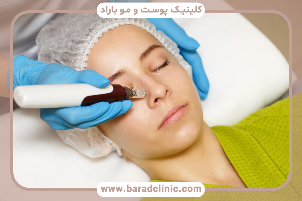 نیدلینگ صورت چیست و چه مزایایی دارد؟