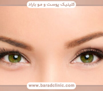 جراحی چشم گربهای