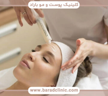 کربوکسی تراپی صورت