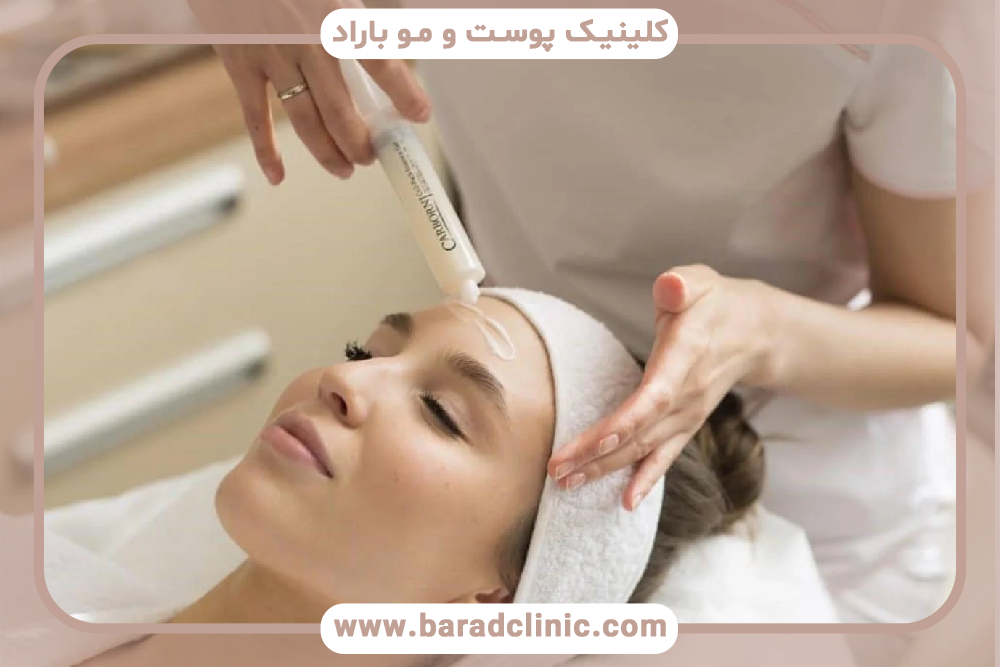 کربوکسی تراپی صورت