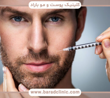 تزریق چربی برای صورت آقایان
