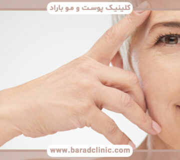 راه های درمان افتادگی پوست چیست؟