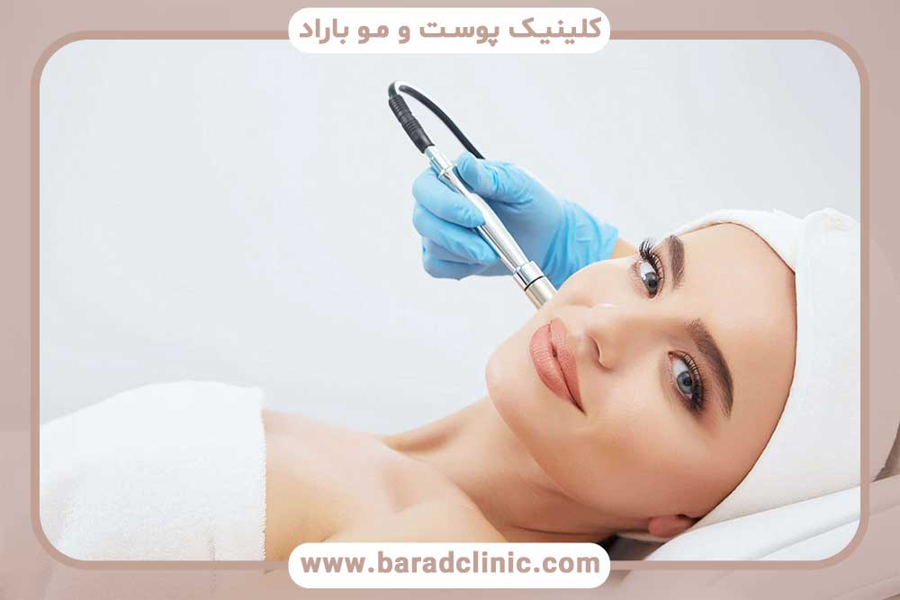 Microdermabrasion services