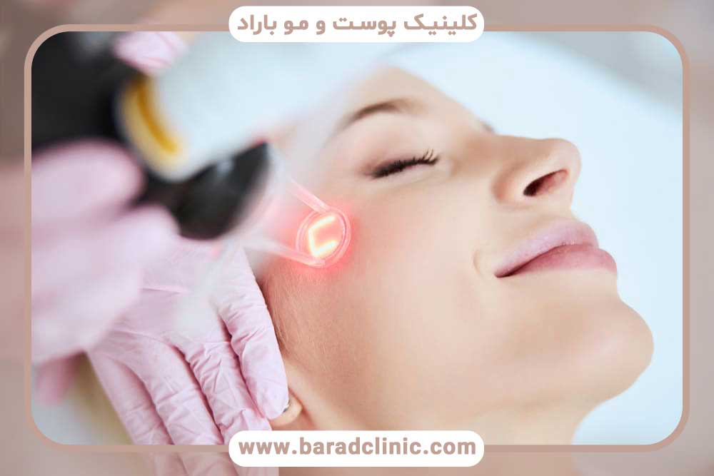 Essential post-laser care