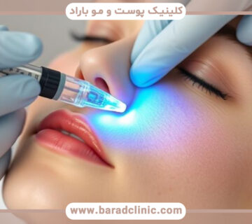کاربرد تزریق مزوژل در جوانسازی پوست