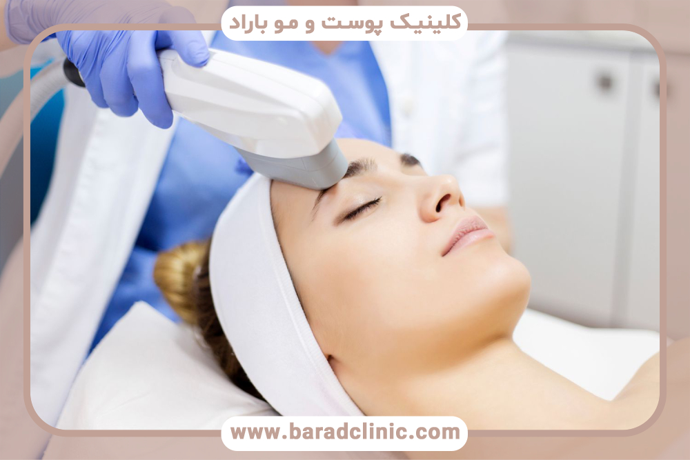 مزایای لیزر جوش صورت چیست