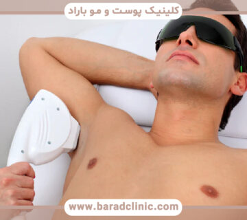 رفع موهای زائد با لیزر و اپیلاسیون