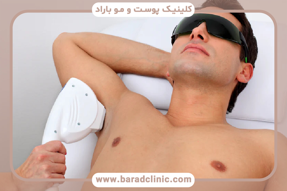 رفع موهای زائد با لیزر و اپیلاسیون