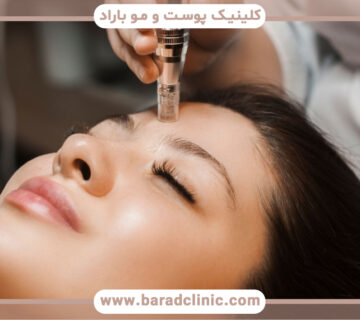 What is facial mesoneedling and what are its benefits?