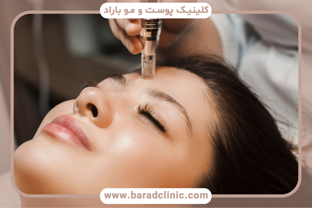 What is facial mesoneedling and what are its benefits?