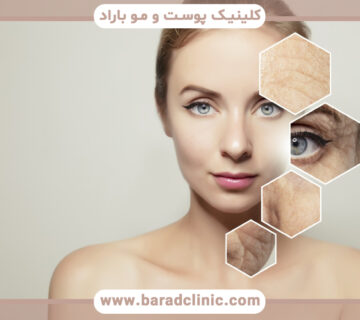 تاثیر پی آر اف در جوانسازی پوست چیست