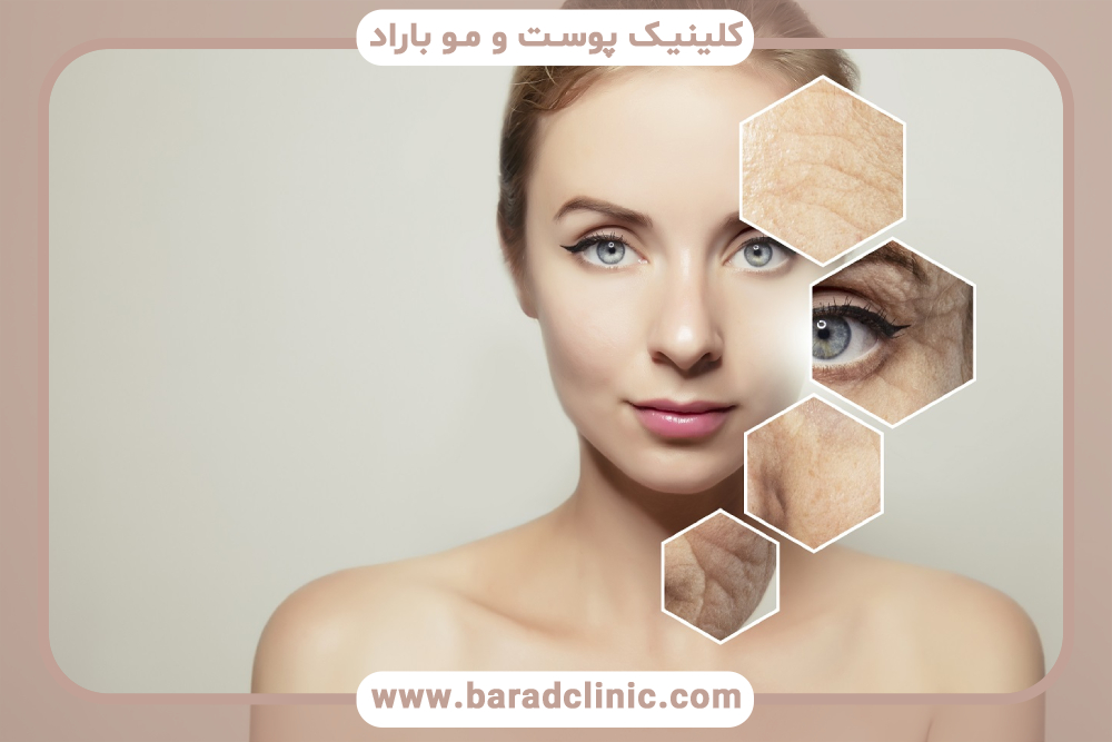 تاثیر پی آر اف در جوانسازی پوست چیست