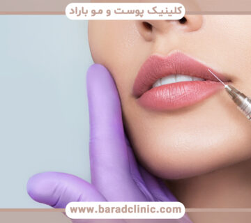 ژل لب روسی