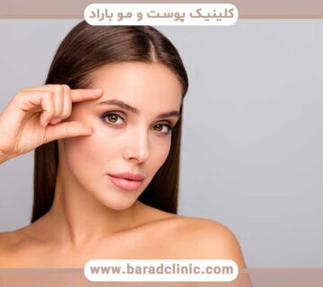 Benefits of eyebrow transplant