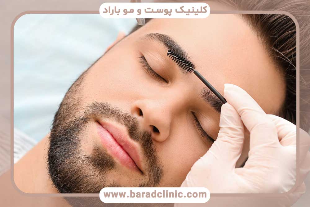 Eyebrow transplantation for men