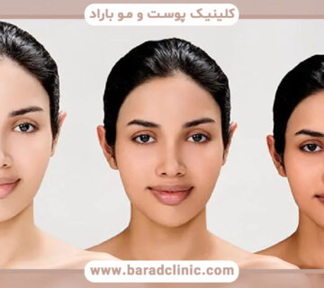 روشن کردن پوست