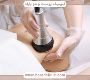 لاغری موضعی با کویتیشن چیست