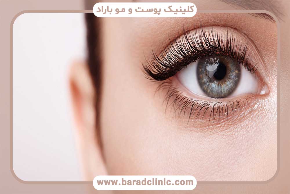 Removing puffiness under the eyes with laser