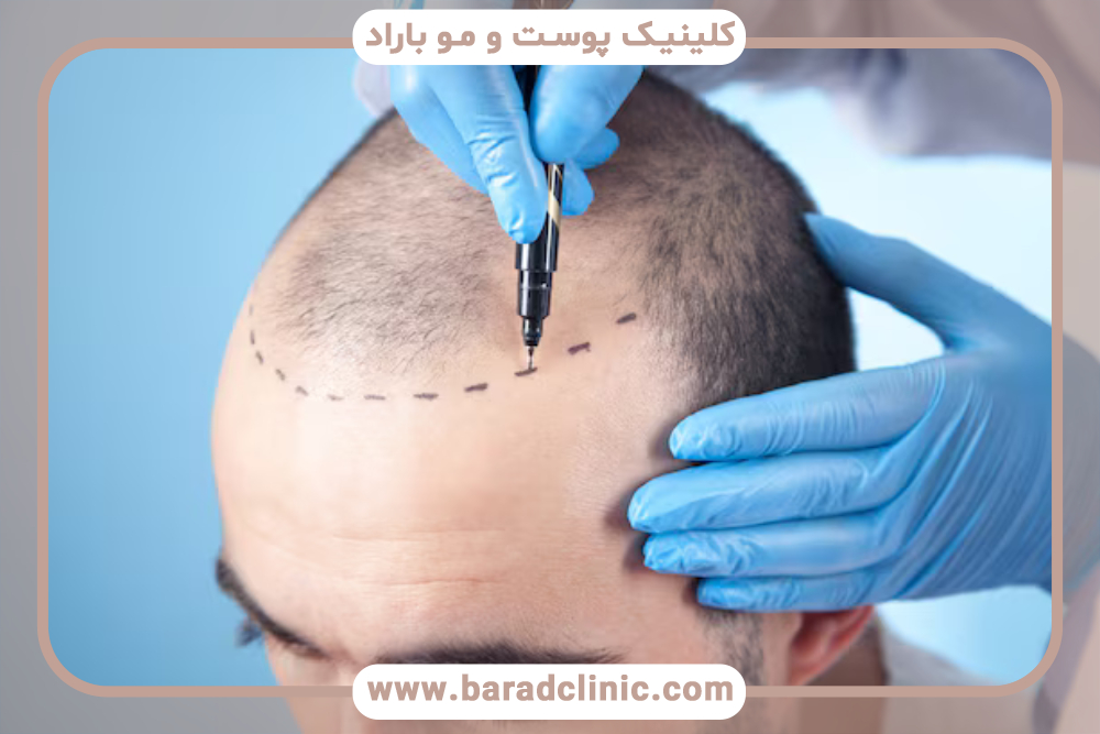 آیا بانک موی برداشت شده مجدد پر می‌شود؟