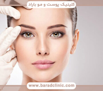 جراحی لیفت شقیقه چگونه انجام میشود؟