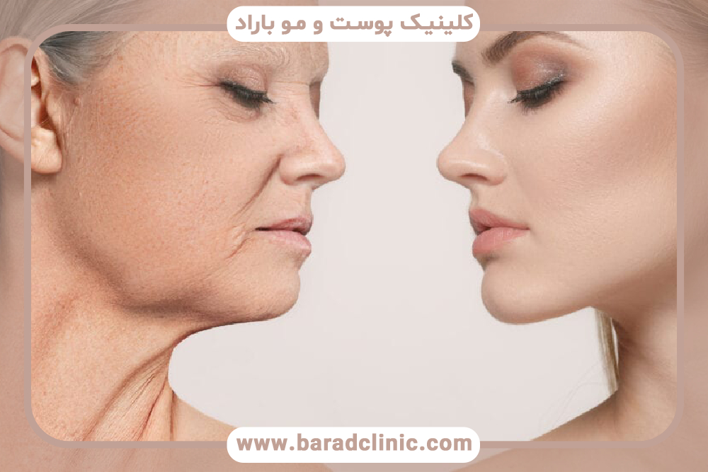 درمان شلی پوست صورت