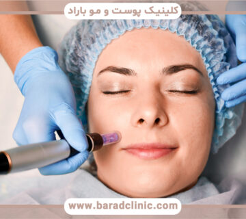درمان درماپن چیست و چه مزایایی دارد؟