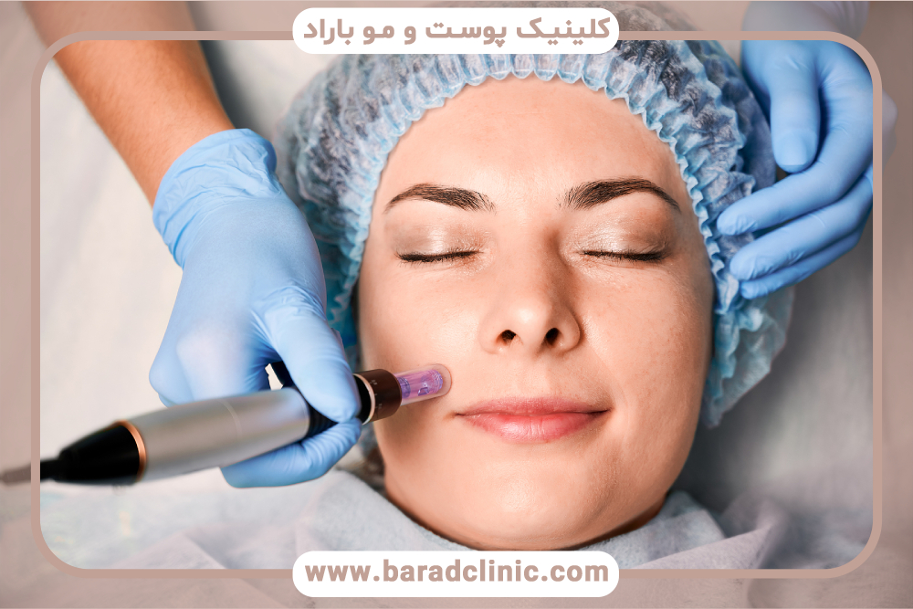 درمان درماپن چیست و چه مزایایی دارد؟