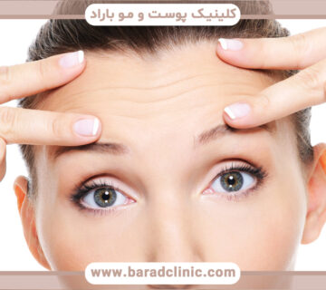 معرفی عمل جراحی لیفت پیشانی