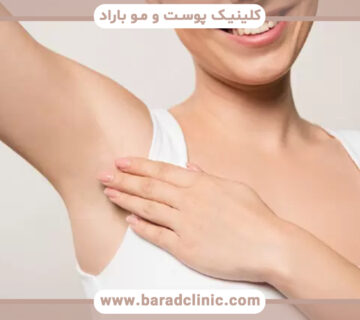 درمان تیرگی و سیاهی زیر بغل با چه روشهایی ممکن است؟