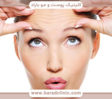 آیا لیزر فرکسل برای رفع چین و چروک پوست مناسب است؟