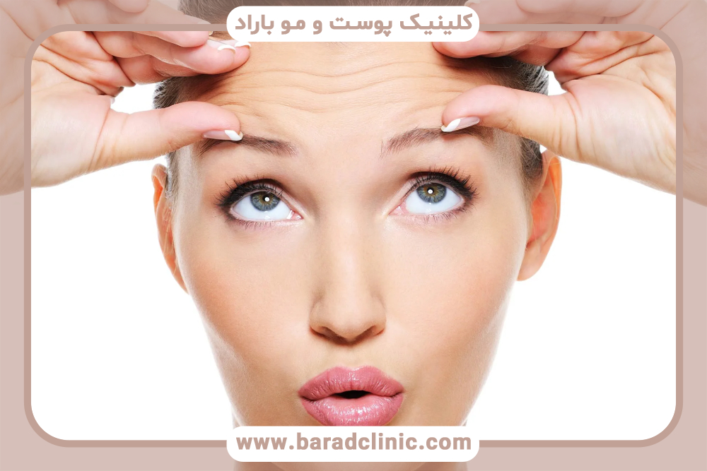 آیا لیزر فرکسل برای رفع چین و چروک پوست مناسب است؟