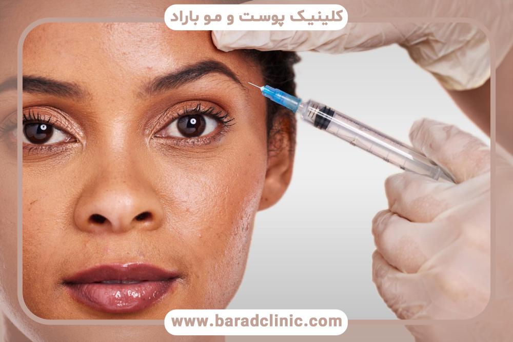 لیفت ابرو با بوتاکس برای چشمهای افتاده