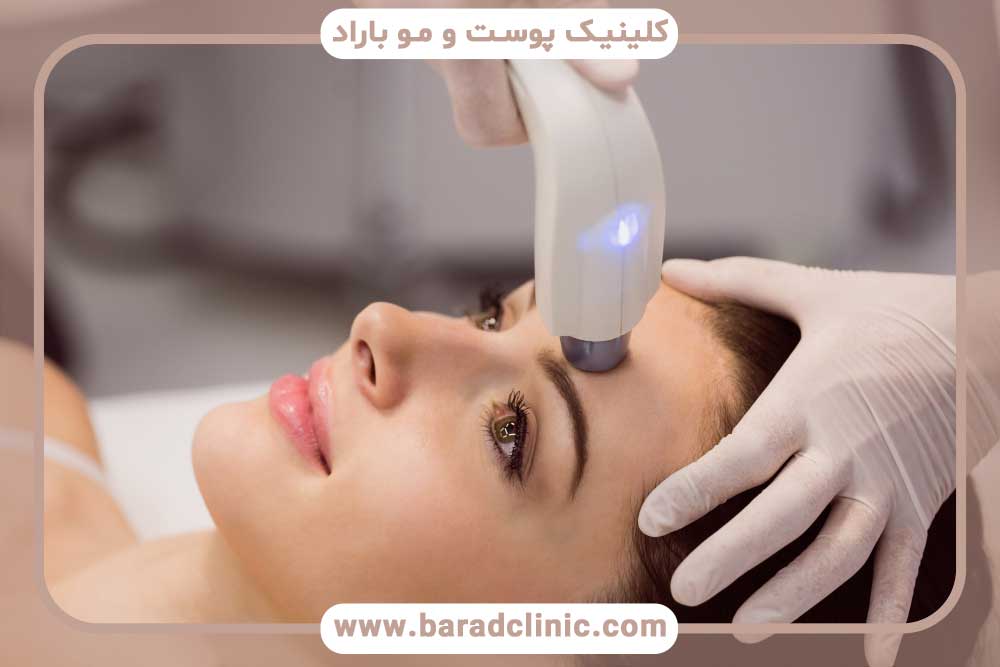 skin laser