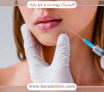 Facial contouring with gel