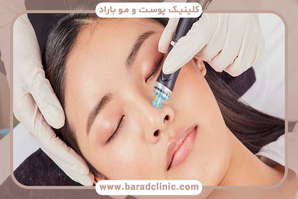 hydrofacial