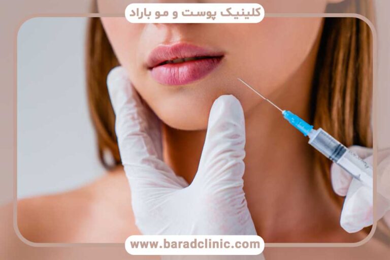 Facial contouring with gel