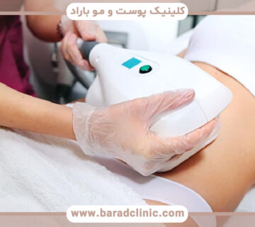 تأثیر دستگاه RF برای لاغری چقدر است؟