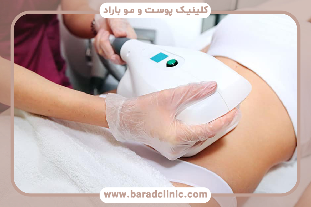 تأثیر دستگاه RF برای لاغری چقدر است؟