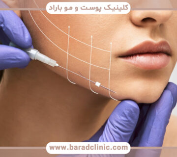 مقایسه هایفوتراپی با سایر روشهای لیفتینگ پوست