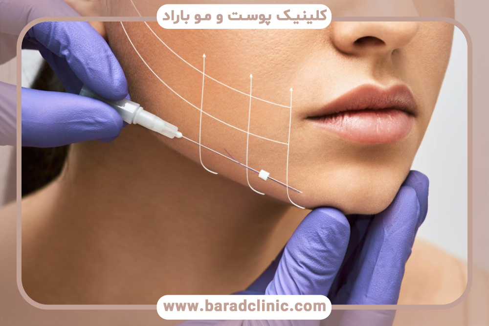 مقایسه هایفوتراپی با سایر روش‌های لیفتینگ پوست