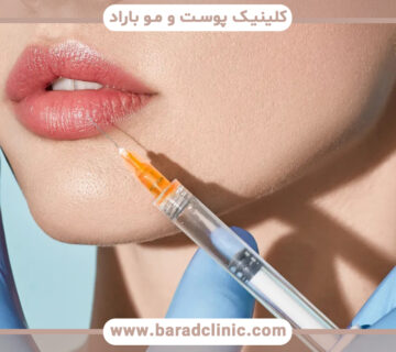 ممنوعیت تزریق ژل برای چه کسانی وجود دارد؟